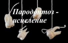 Пародонтоз, пародонтит - исцеление
